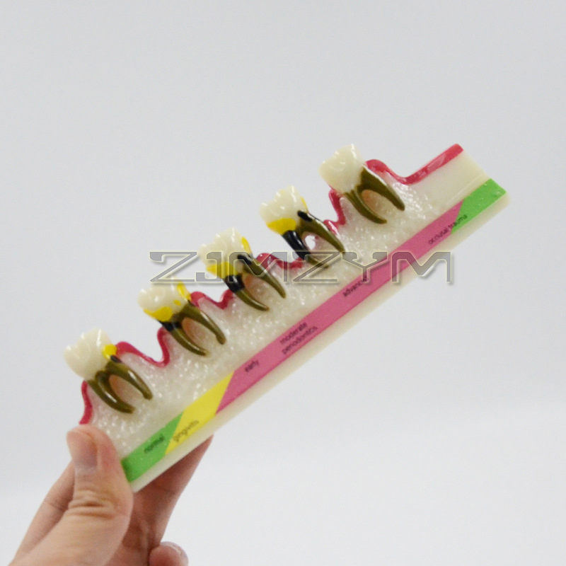 Periodontal Disease Model Dent - đánh giá và giá Medical Lab Study